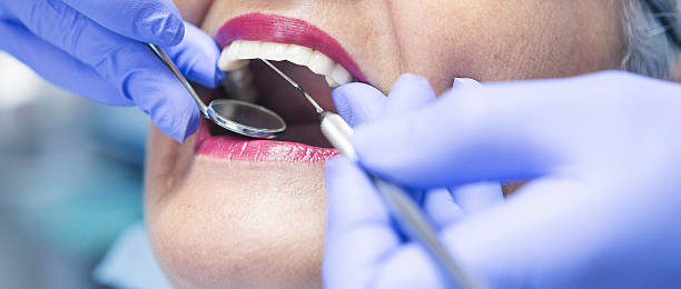 Best Knocked-Out Tooth (Avulsed Tooth) Treatment in Forest, OH